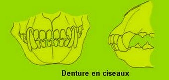 dentition ciseaux